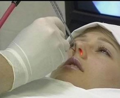 Особенности протекания и методы терапии аллергического вазомоторного ринита Особенности протекания и методы терапии аллергического вазомоторного ринита