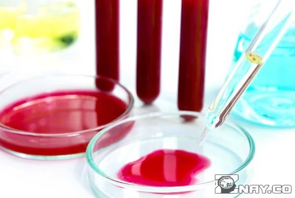 Что означает повышенный уровень АЛТ в крови? Что означает повышенный уровень АЛТ в крови?