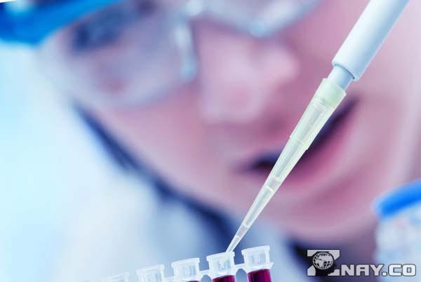 Что означает повышенный уровень АЛТ в крови? Что означает повышенный уровень АЛТ в крови?