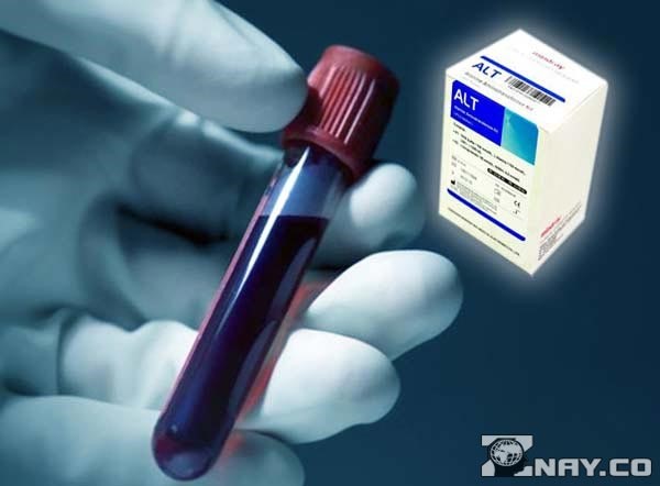 Что означает повышенный уровень АЛТ в крови? Что означает повышенный уровень АЛТ в крови?
