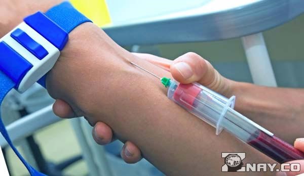 Что означает повышенный уровень АЛТ в крови? Что означает повышенный уровень АЛТ в крови?