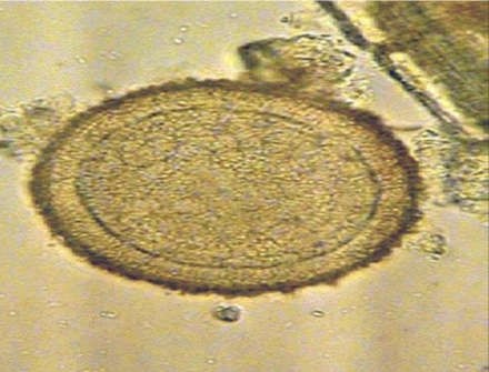 Как правильно сдавать анализ кала на яйца глистов? Как правильно сдавать анализ кала на яйца глистов?