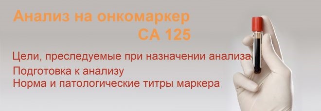 Анализ крови на онкомаркеры, расшифровка (норма СА 125) Анализ крови на онкомаркеры, расшифровка (норма СА 125)