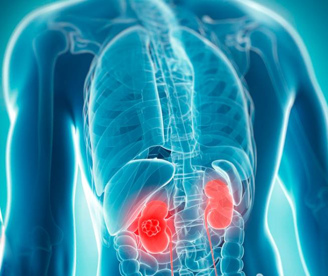 Описание анализа мочи на микроальбуминарию Описание анализа мочи на микроальбуминарию