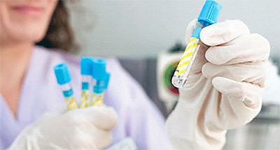 Анализ крови на свертываемость Анализ крови на свертываемость