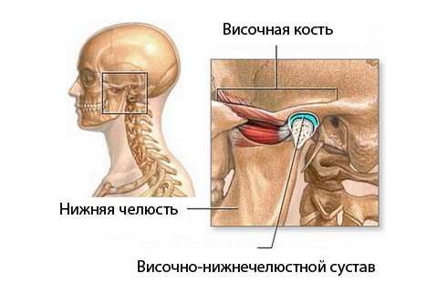 Артроз височно-нижнечелюстного сустава: симптомы и лечение ВНСЧ Артроз височно-нижнечелюстного сустава: симптомы и лечение ВНСЧ