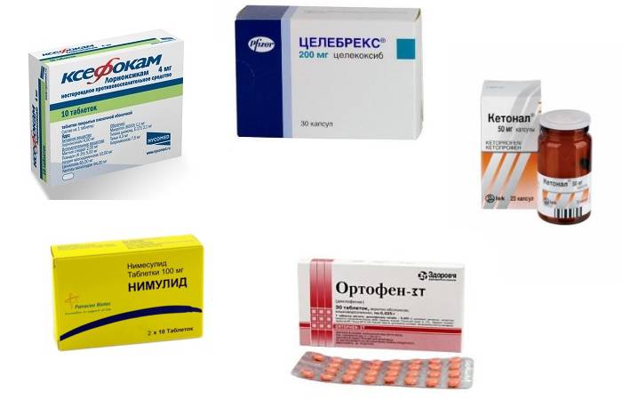 Как распознать и лечить артроз пальцев рук Как распознать и лечить артроз пальцев рук