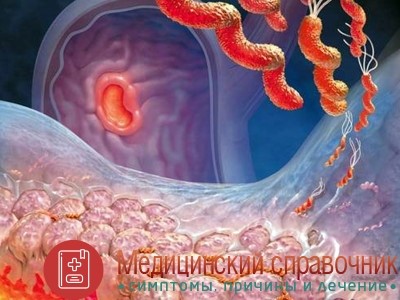 Профилактика и лечение атрофического очагового гастрита Профилактика и лечение атрофического очагового гастрита