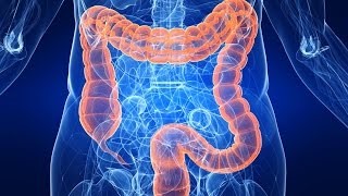 Чем лечить атрофический колит кишечника? Чем лечить атрофический колит кишечника?