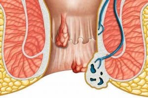 Капли и бальзам Витаон Капли и бальзам Витаон