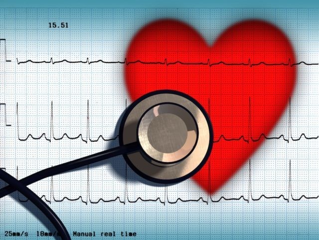 Можно ли служить в армии с синусовой аритмией? Можно ли служить в армии с синусовой аритмией?