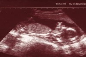 Диарея при беременности на ранних сроках: причины и методы лечения поноса Диарея при беременности на ранних сроках: причины и методы лечения поноса