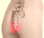 Ноющая боль в области груди и сердца: симптомы и лечение Ноющая боль в области груди и сердца: симптомы и лечение