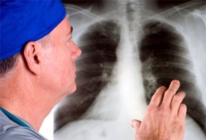 Ноющая боль в области груди и сердца: симптомы и лечение Ноющая боль в области груди и сердца: симптомы и лечение