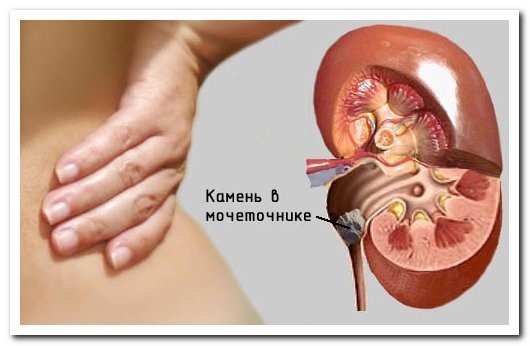 Болит спина и тяжело дышать Болит спина и тяжело дышать
