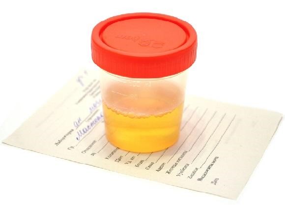 Что можно принять при боли в желудке? Что можно принять при боли в желудке?