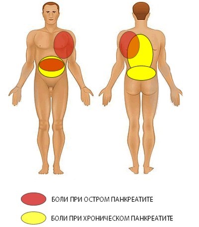 Болит спина сзади слева Болит спина сзади слева