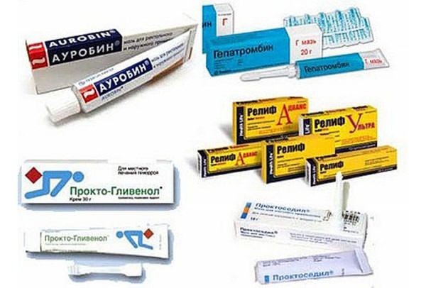 Боли в прямой кишке при беременности: почему, от чего и что делать? Боли в прямой кишке при беременности: почему, от чего и что делать?