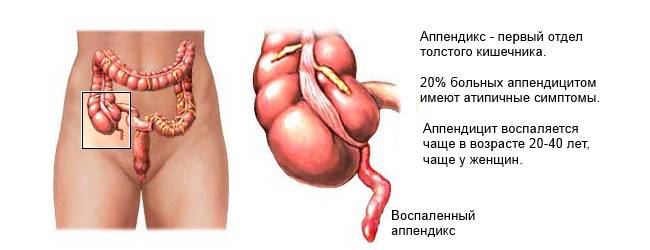 Ноющие боли в желудке - следствие проблем с ЖКТ Ноющие боли в желудке - следствие проблем с ЖКТ