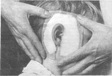 Лечение отита борной кислотой Лечение отита борной кислотой