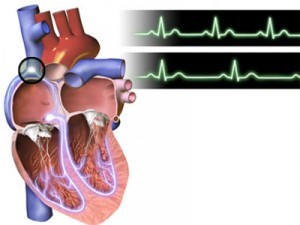Как лечить брадикардию народными средствами Как лечить брадикардию народными средствами