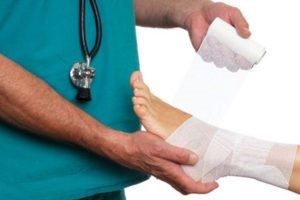 Бурсит голеностопного сустава: лечение, симптомы, фото стопы Бурсит голеностопного сустава: лечение, симптомы, фото стопы