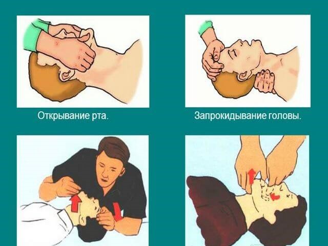 Черепно-мозговая травма (ЧМТ): симптомы, лечение, последствия Черепно-мозговая травма (ЧМТ): симптомы, лечение, последствия