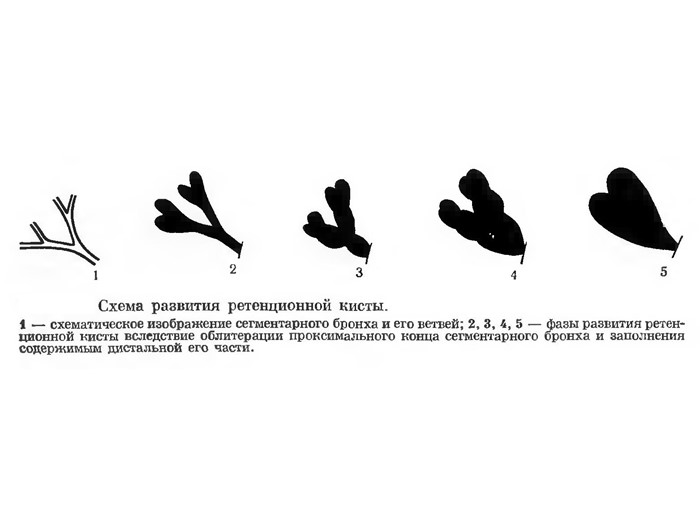 Что может выявить флюорография? Что может выявить флюорография?