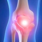 Что такое артроз: причины возникновения, методы лечения и последствия болезни Что такое артроз: причины возникновения, методы лечения и последствия болезни