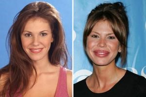 Диареи после антибиотиков – как лечить? Диареи после антибиотиков – как лечить?