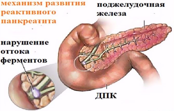 Диета при остром панкреатите Диета при остром панкреатите
