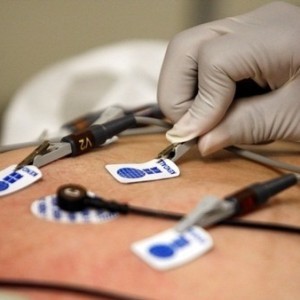 Медикаментозное лечение аритмии: обзор препаратов Медикаментозное лечение аритмии: обзор препаратов