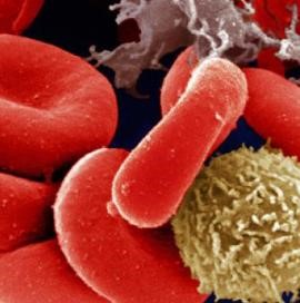 Фибриноген: норма, повышен в крови (высокий), понижен Фибриноген: норма, повышен в крови (высокий), понижен