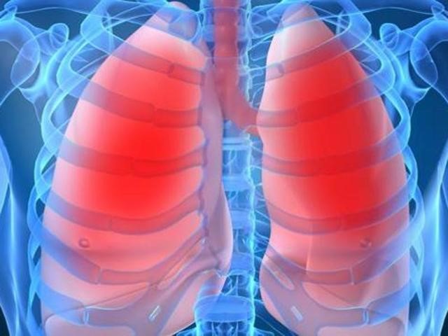 Необходимость проведения флюорографии при пневмонии Необходимость проведения флюорографии при пневмонии