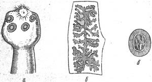 Тяжелый гельминтоз - бычий цепень у человека Тяжелый гельминтоз - бычий цепень у человека