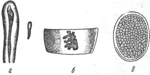 Тяжелый гельминтоз - бычий цепень у человека Тяжелый гельминтоз - бычий цепень у человека