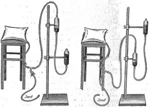 Тяжелый гельминтоз - бычий цепень у человека Тяжелый гельминтоз - бычий цепень у человека
