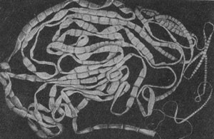 Тяжелый гельминтоз - бычий цепень у человека Тяжелый гельминтоз - бычий цепень у человека