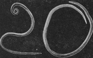 Тяжелый гельминтоз - бычий цепень у человека Тяжелый гельминтоз - бычий цепень у человека