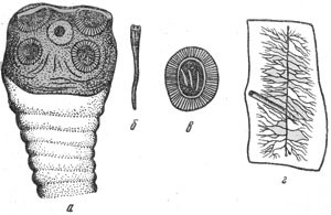 Тяжелый гельминтоз - бычий цепень у человека Тяжелый гельминтоз - бычий цепень у человека