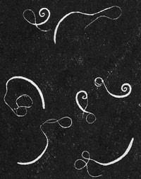 Тяжелый гельминтоз - бычий цепень у человека Тяжелый гельминтоз - бычий цепень у человека