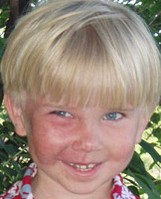 Венозная гемангиома сосудов Венозная гемангиома сосудов