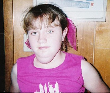 Венозная гемангиома сосудов Венозная гемангиома сосудов