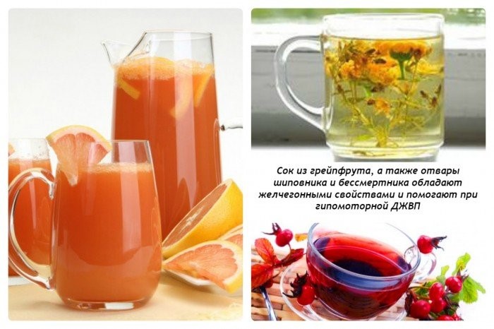 Гипокинетическая дискинезия желчевыводящих путей Гипокинетическая дискинезия желчевыводящих путей