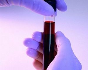 Зачем проверять гликированный гемоглобин? Зачем проверять гликированный гемоглобин?