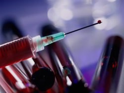 HBsAg анализ крови – что это такое HBsAg анализ крови – что это такое