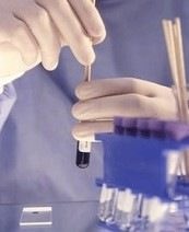 HBsAg анализ крови – что это такое HBsAg анализ крови – что это такое