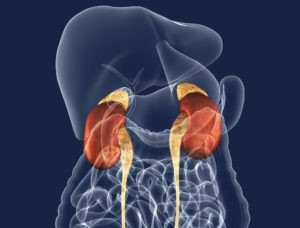 Инфаркт: некротическое поражение почек Инфаркт: некротическое поражение почек