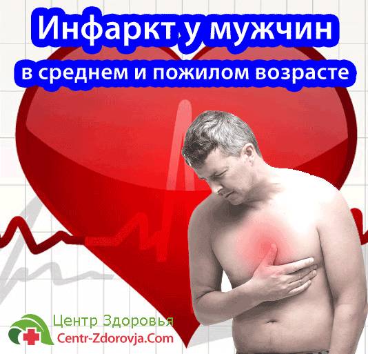 Признаки развивающегося инфаркта миокарда у мужчин и какую помощь нужно оказать? Признаки развивающегося инфаркта миокарда у мужчин и какую помощь нужно оказать?