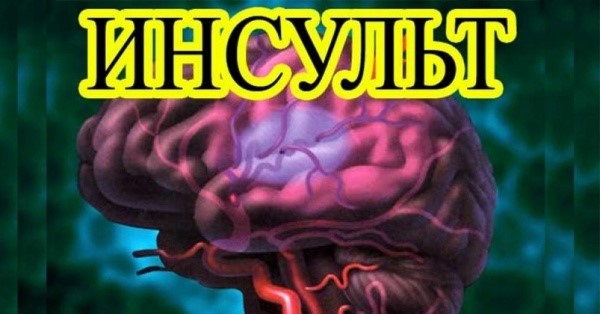 Причины инсульта головного мозга Причины инсульта головного мозга